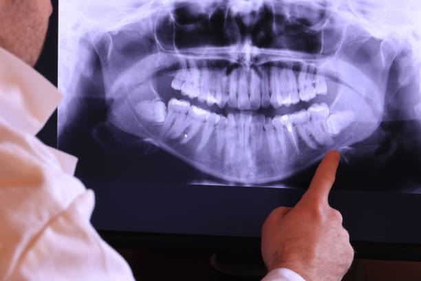 Best Chipped Tooth Repair Near Me  in Lynchburg, VA