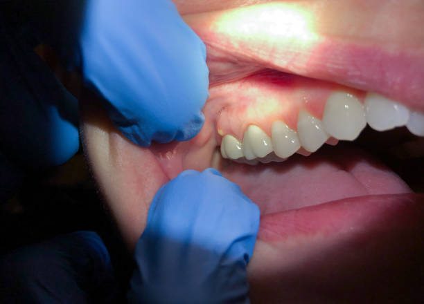 Best Emergency Dentist Near Me  in Lynchburg, VA