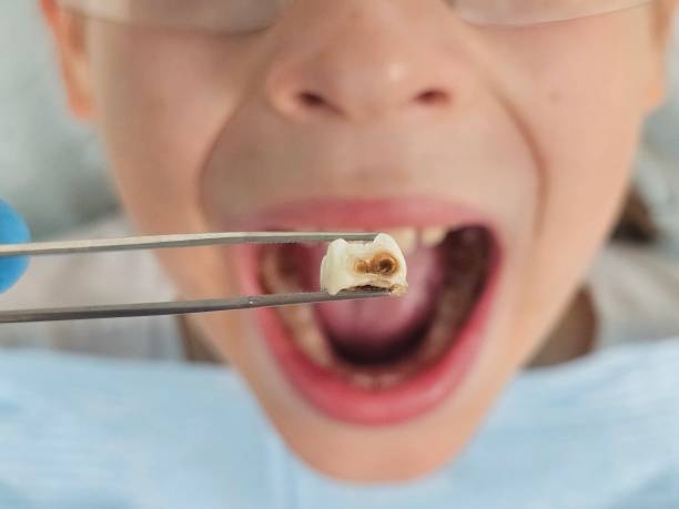 Best Emergency Pediatric Dentist  in Lynchburg, VA